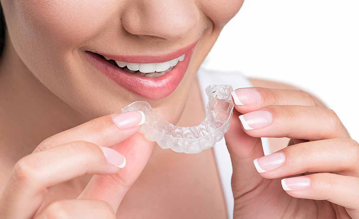 Ortodontik tedavide diş telleri mi şeffaf plaklar mı?