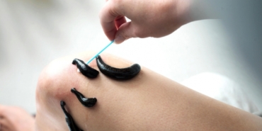 Sülük Tedavisi Nedir?