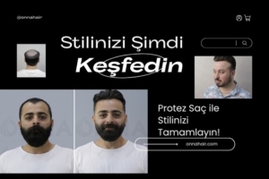 Protez Saç ile Yeni Başlangıç Yapın