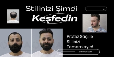 Protez Saç ile Yeni Başlangıç Yapın